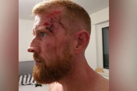 Liam Conway wurde auf der Polizeiwache Idstein im September 2020 verletzt. 