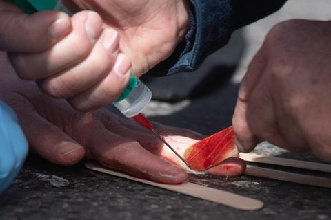 Ein Arzt löst während eines Protests der Gruppe "Letzte Generation" die blutende Hand eines Demonstranten. Dieser hatte sich mit Sekundenkleber auf der Fahrbahn festgeklebt. Foto: dpa