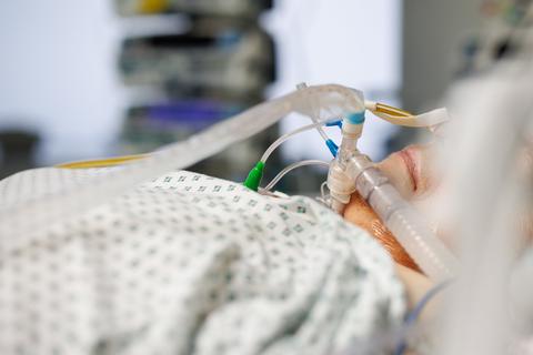 Ein über einen Luftröhrenschnitt beatmeter Corona-Patient liegt in einem Intensivbett-Zimmer in der Asklepios Klinik in Gauting in Bayern.  Foto: Matthias Balk/dpa